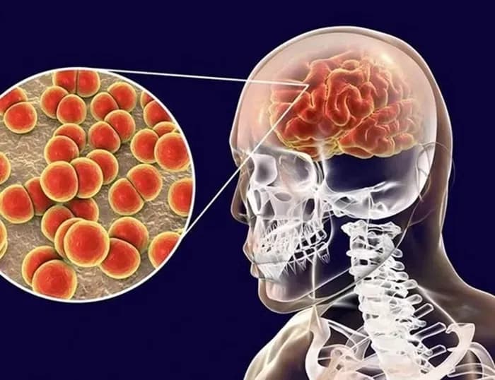 Cảnh báo: Khói thuốc lá làm tăng nguy cơ mắc não mô cầu ở trẻ em