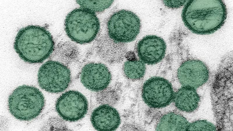 Hoa Kỳ lên kế hoạch sơ tán công dân khỏi du thuyền bùng phát hantavirus